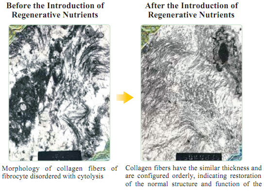 菲彩国际集团_Part One: In situ Skin Regenerative Restoration & Rejuvenati