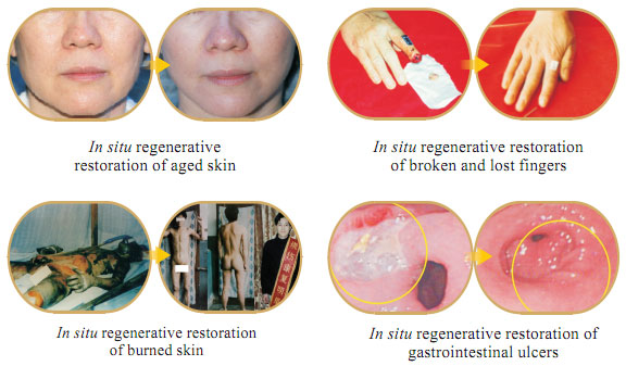 菲彩国际集团_Part One: In situ Skin Regenerative Restoration & Rejuvenati
