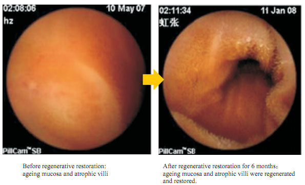 菲彩国际集团_How is an aged cell regenerated?