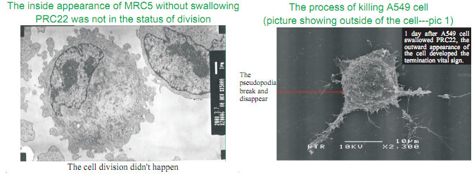 菲彩国际集团_The mystery of cancer and the relation between cancer and re