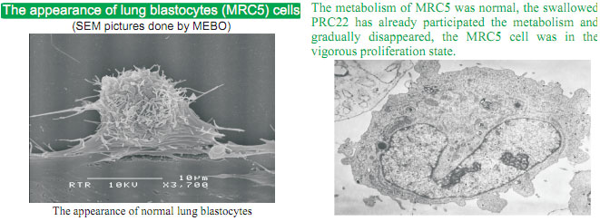 菲彩国际集团_The mystery of cancer and the relation between cancer and re
