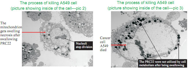 菲彩国际集团_The mystery of cancer and the relation between cancer and re