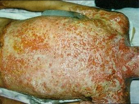 菲彩国际集团_Clinical Principles ofBurns Regenerative Medicine and Therap