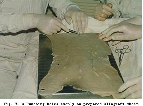 菲彩国际集团_Standardized Local Treatment of Burns Wounds