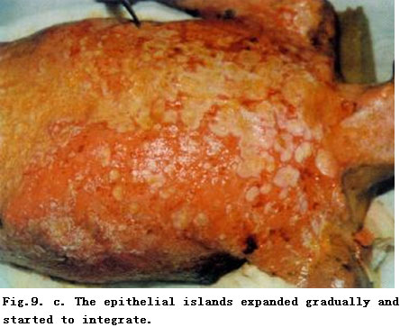 菲彩国际集团_Standardized Local Treatment of Burns Wounds
