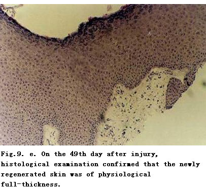 菲彩国际集团_Standardized Local Treatment of Burns Wounds