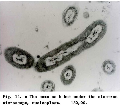 菲彩国际集团_Experimental research on the Mechanism of the Anti-infection
