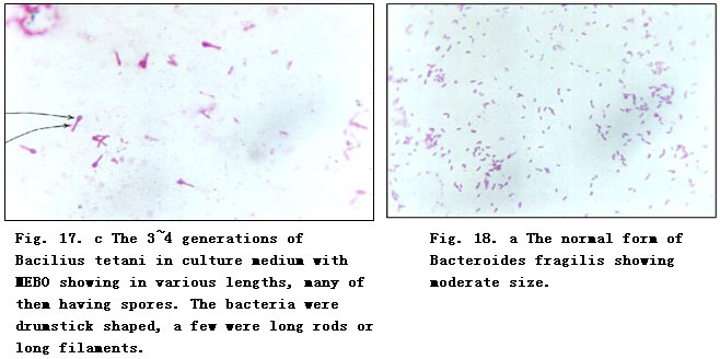 菲彩国际集团_Experimental Research on the Anti-Anaerobic and Anti-Fungal