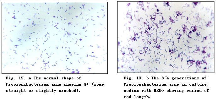 菲彩国际集团_Experimental Research on the Anti-Anaerobic and Anti-Fungal