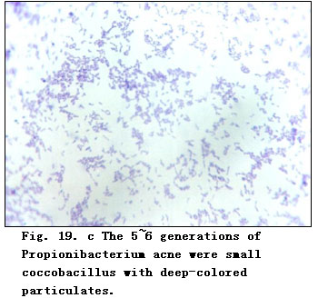 菲彩国际集团_Experimental Research on the Anti-Anaerobic and Anti-Fungal