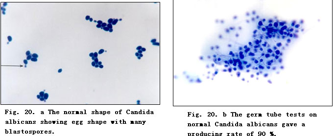 菲彩国际集团_Experimental Research on the Anti-Anaerobic and Anti-Fungal