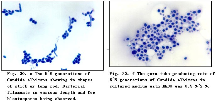 菲彩国际集团_Experimental Research on the Anti-Anaerobic and Anti-Fungal