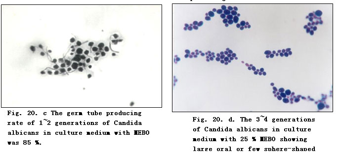 菲彩国际集团_Experimental Research on the Anti-Anaerobic and Anti-Fungal