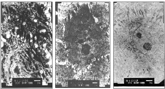 菲彩国际集团_Electron-Microscopic Observation of One Case of Skins Burns