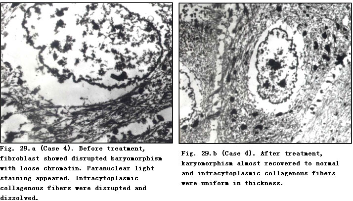 菲彩国际集团_Pathomorphological Changes of Deep Burns Wounds Treated with