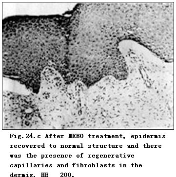 菲彩国际集团_Electron-Microscopic Observation of One Case of Skins Burns