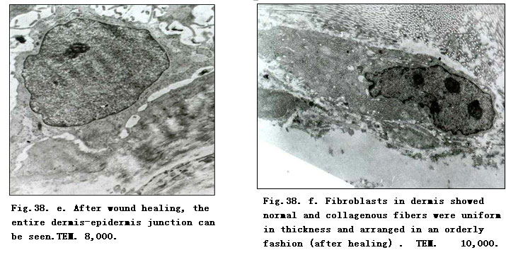 菲彩国际集团_Physiological Healing Procedure and Histological Observation