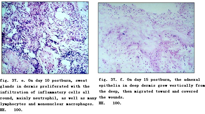 菲彩国际集团_Physiological Healing Procedure and Histological Observation