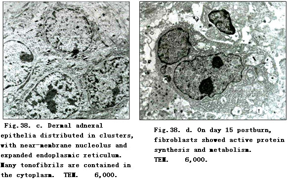 菲彩国际集团_Physiological Healing Procedure and Histological Observation