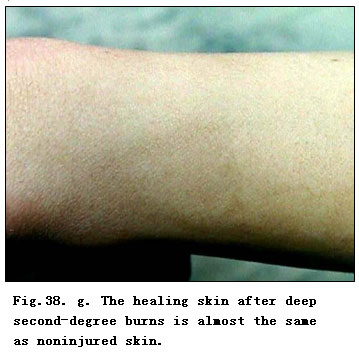 菲彩国际集团_Physiological Healing Procedure and Histological Observation