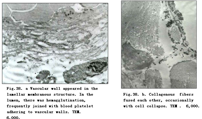 菲彩国际集团_Physiological Healing Procedure and Histological Observation