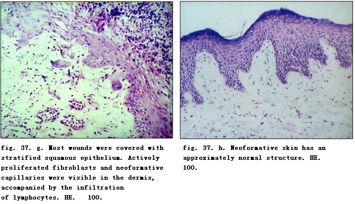 菲彩国际集团_Physiological Healing Procedure and Histological Observation