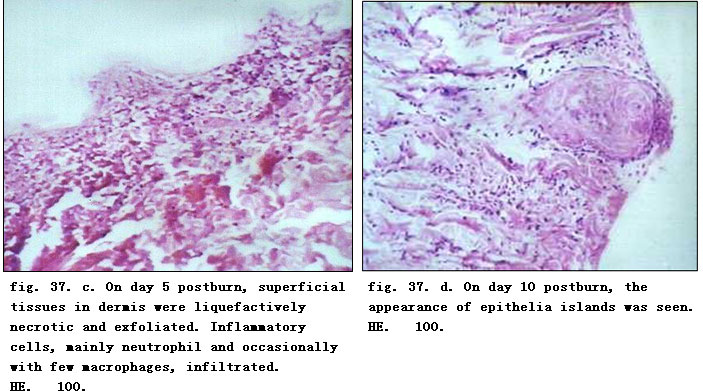菲彩国际集团_Physiological Healing Procedure and Histological Observation