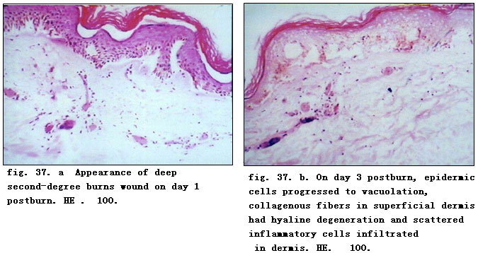 菲彩国际集团_Physiological Healing Procedure and Histological Observation
