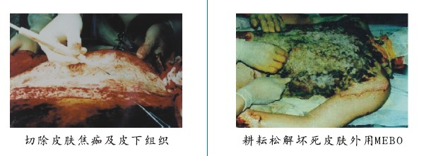 菲彩国际集团_四、两种疗法疗效比照举例（图示）