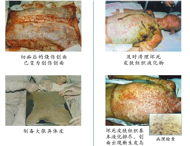 菲彩国际集团_四、两种疗法疗效比照举例（图示）