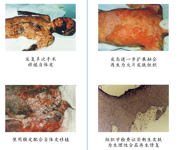 菲彩国际集团_四、两种疗法疗效比照举例（图示）