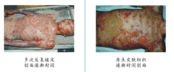 菲彩国际集团_四、两种疗法疗效比照举例（图示）
