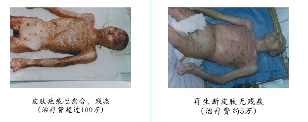 菲彩国际集团_四、两种疗法疗效比照举例（图示）