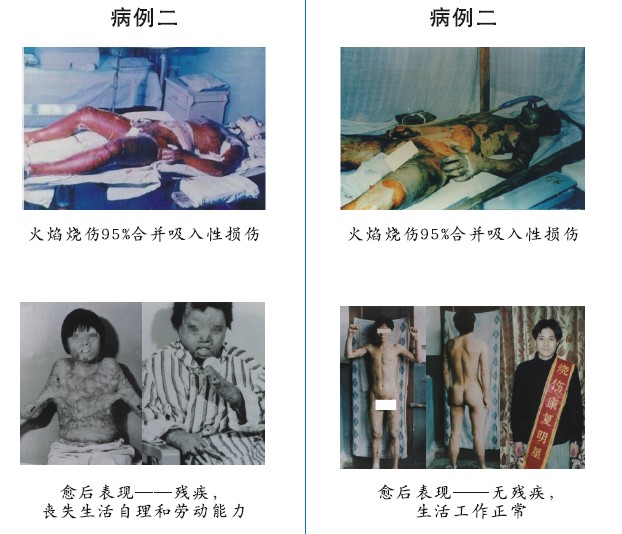菲彩国际集团_四、两种疗法疗效比照举例（图示）