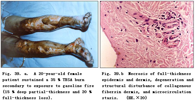 菲彩国际集团_Clinical Procedure and Histological Observation of Full-Thic