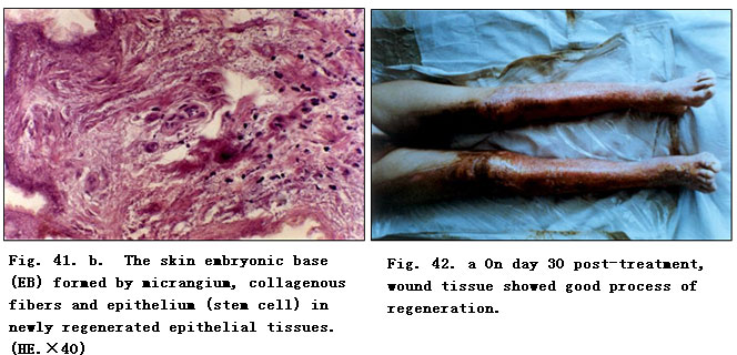 菲彩国际集团_Clinical Procedure and Histological Observation of Full-Thic
