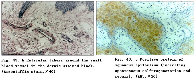 菲彩国际集团_Clinical Procedure and Histological Observation of Full-Thic
