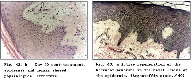 菲彩国际集团_Clinical Procedure and Histological Observation of Full-Thic