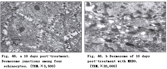 菲彩国际集团_Clinical Procedure and Histological Observation of Full-Thic