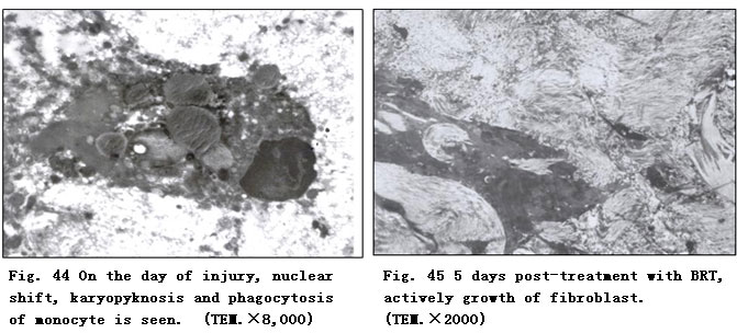 菲彩国际集团_Clinical Procedure and Histological Observation of Full-Thic