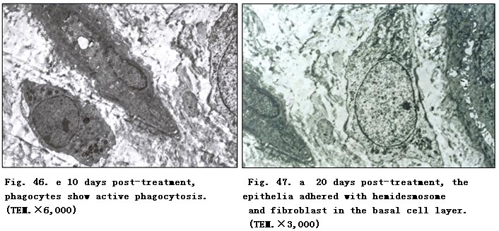 菲彩国际集团_Clinical Procedure and Histological Observation of Full-Thic