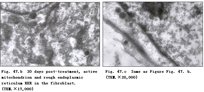 菲彩国际集团_Clinical Procedure and Histological Observation of Full-Thic