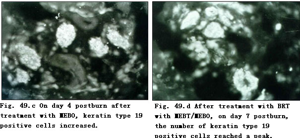 菲彩国际集团_Effect of BRT with MEBT/MEBO on the Expression and Regenerat