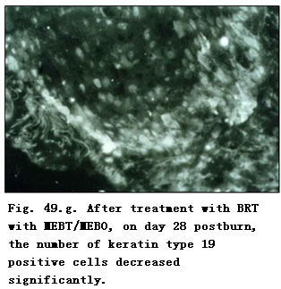 菲彩国际集团_Effect of BRT with MEBT/MEBO on the Expression and Regenerat