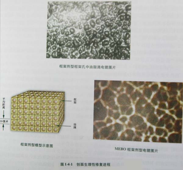 菲彩国际集团_第五节 烧伤皮肤系统再生治疗手艺病例先容