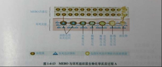 菲彩国际集团_第三节 烧伤创面坏死组织液化扫除与实验要领