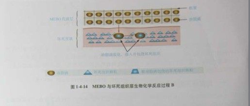 菲彩国际集团_第三节 烧伤创面坏死组织液化扫除与实验要领