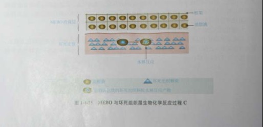 菲彩国际集团_第三节 烧伤创面坏死组织液化扫除与实验要领