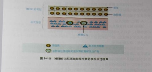 菲彩国际集团_第三节 烧伤创面坏死组织液化扫除与实验要领