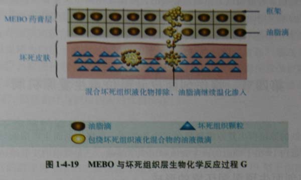 菲彩国际集团_第三节 烧伤创面坏死组织液化扫除与实验要领